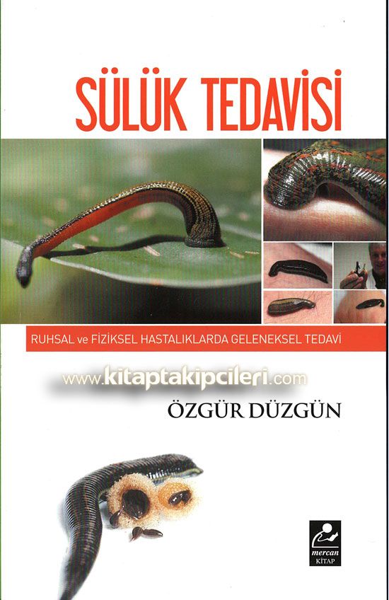 Sülük Tedavisi, Ruhsal ve Fiziksel Hastalıklarda Geleneksel Tedavi, Özgür Düzgün